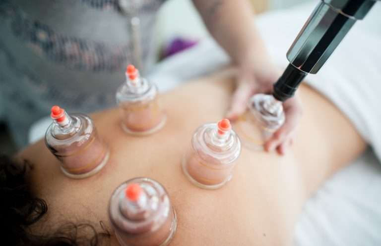 Cupping Therapy: Unveiling Its Health Benefits